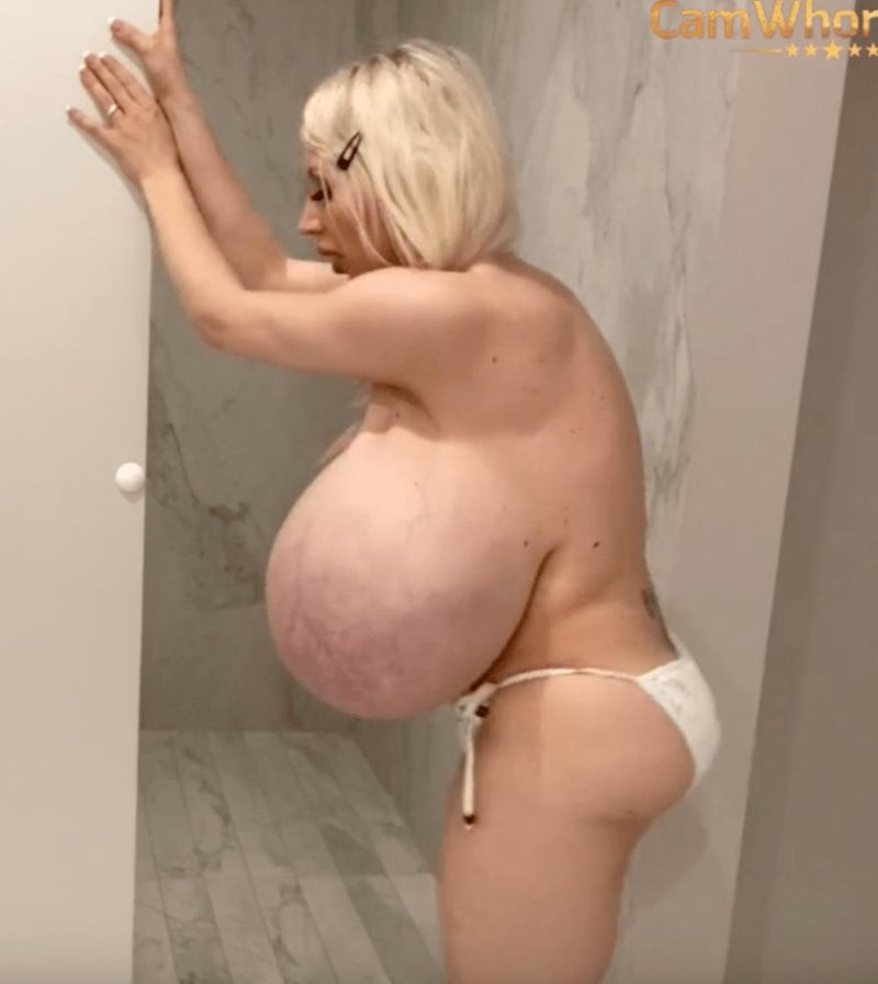 Myra Hills, Beshine, The largest silicone breasts