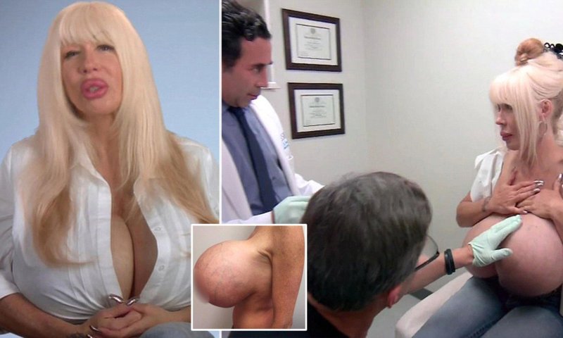 Elizabeth Starr, Silicon boobs, Huge Silicone Tits