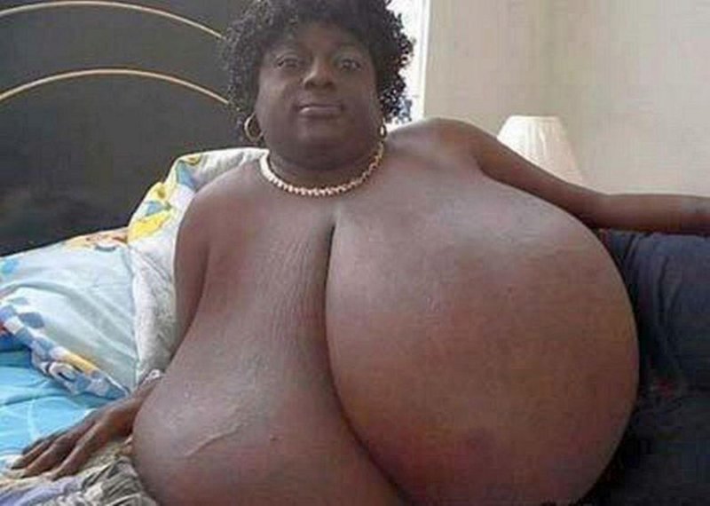 Annie Hawkinsterer, Woman with the biggest tits, Girl with the biggest tits