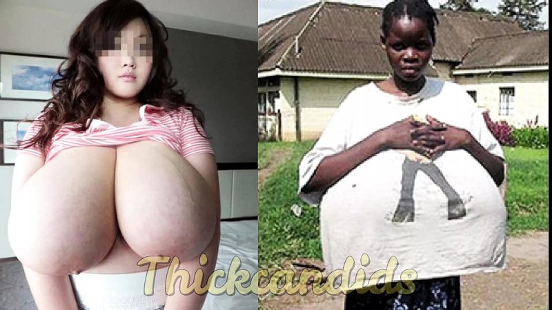 Hitomi Tanaka Macromastia, Macromastia Grenny gigantomastia, Gigantomastia Hulia Manihuari
