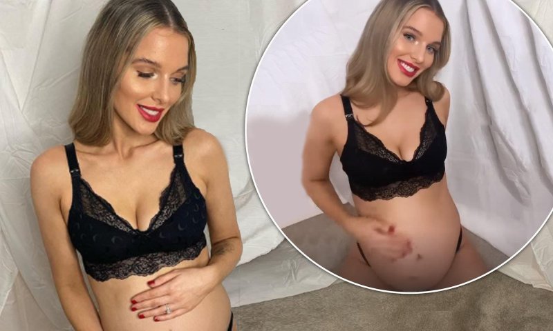Helen flanagan, Helen Flenagan Pregnant, Helen flanagan pregnant