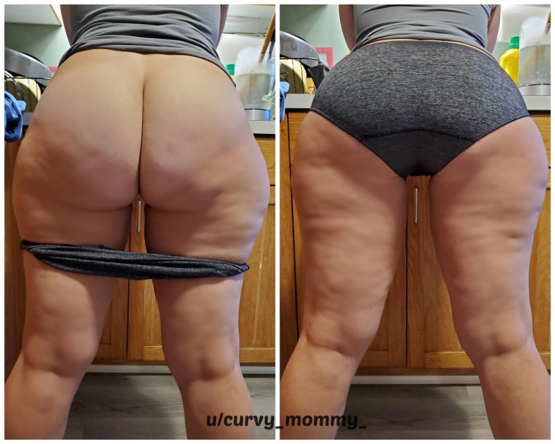 Anti -cellulite massage before and after sessions result, Fat ass, Cellulite