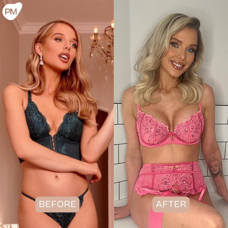 Helen flanagan, Girl, Bracks