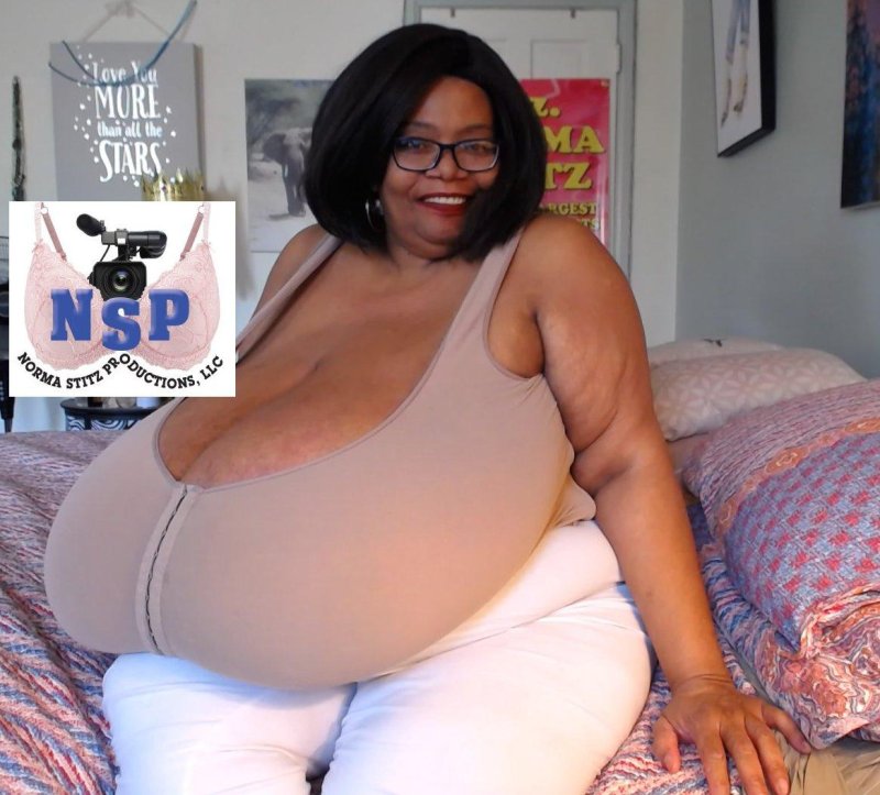 Very big tits Norma Stitz, Macromastia gigantomastia of Grennie, Annie Hawkinsterer