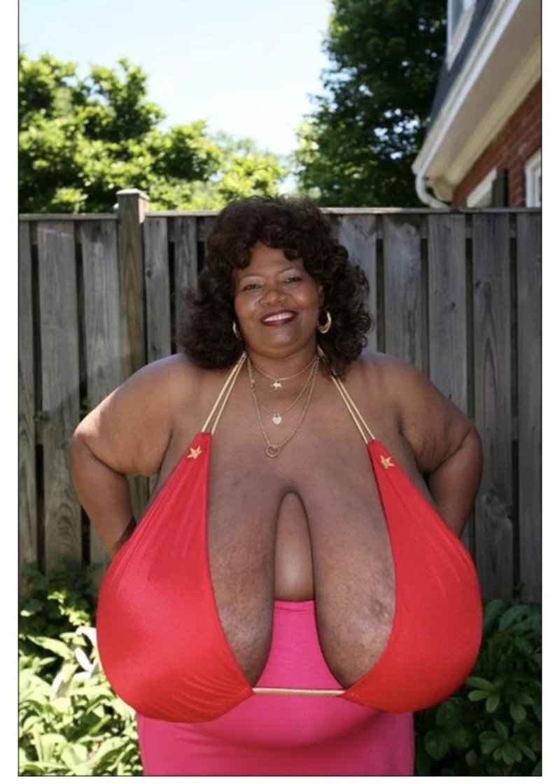 Annie Hawkinster Sters, The largest female breast, Annie Hawkins Turner Breast