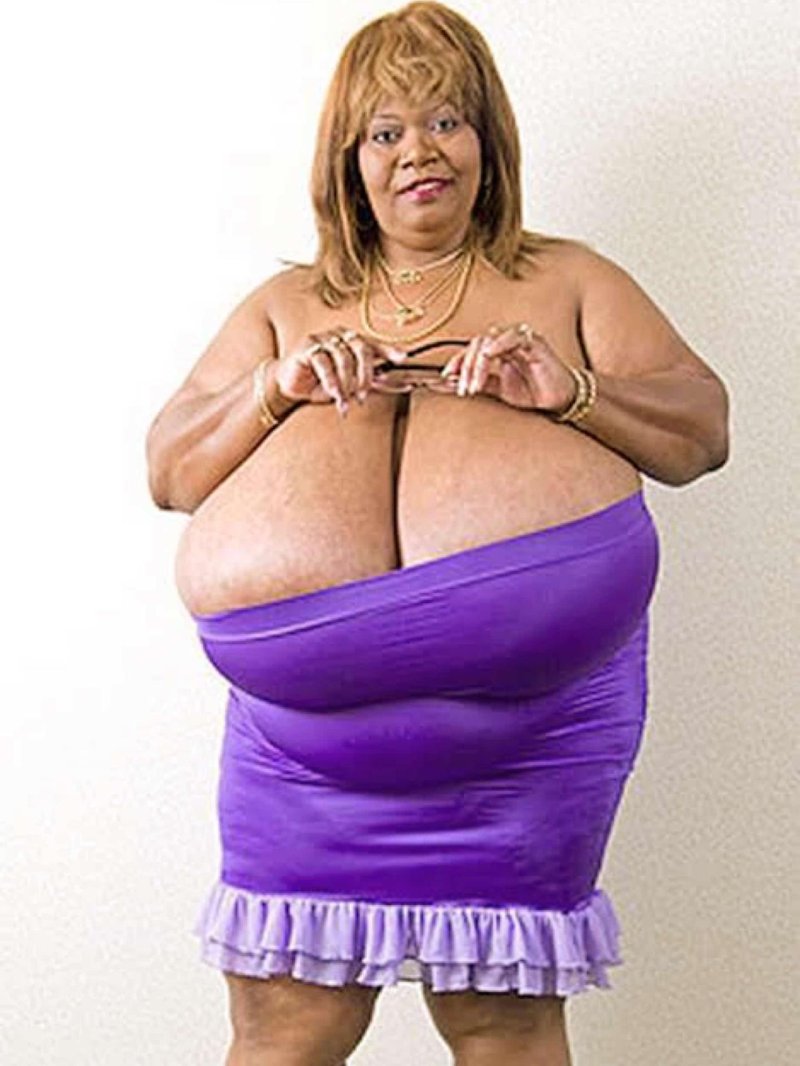Annie Hawkinster Sters, Annie Hawkins Turner Breast, Woman with the biggest breast in world
