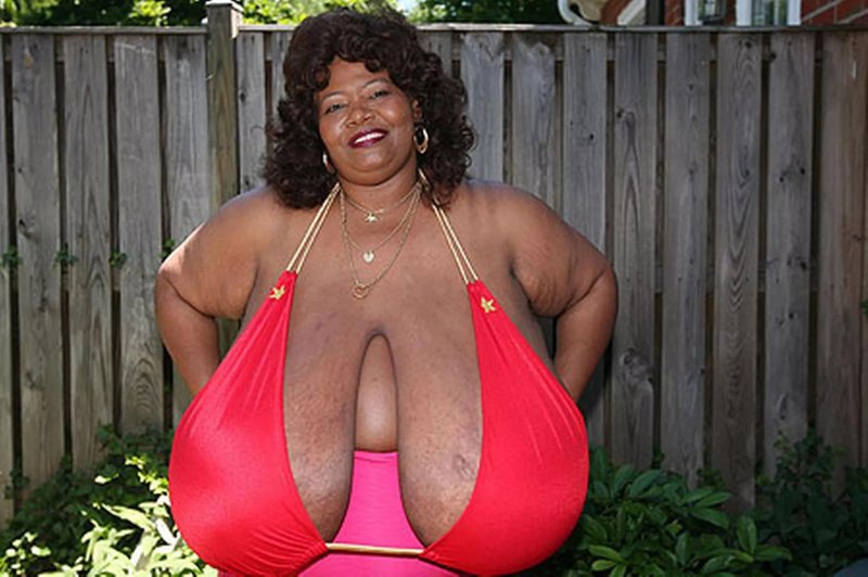 Annie Hawkinster Sters, Woman with the biggest breast in world, Annie Hawkins Turner Big Gud