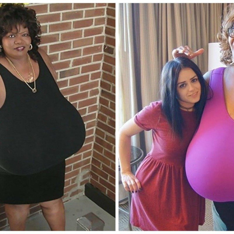 Annie Hawkinster Sters, The largest female breast, The largest breast