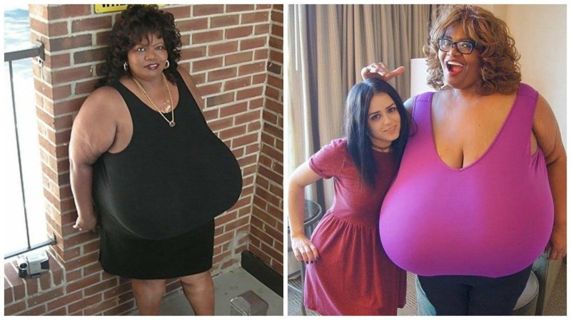 Annie Hawkinster Sters, The largest female breast, Annie Hawkins Turner Breast
