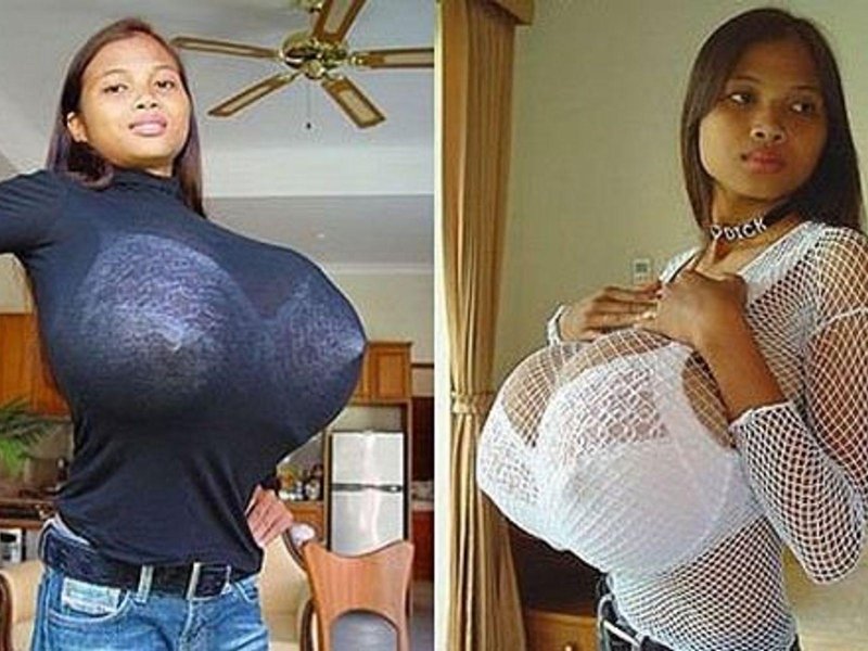The largest breasts in world, Ting Fianhe, Woman with the largest breasts in world