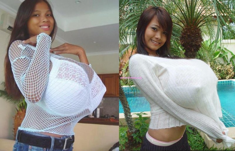 Chinese woman Ting Hiafen, Ting Fianhe, Ting Hiafen before surgery